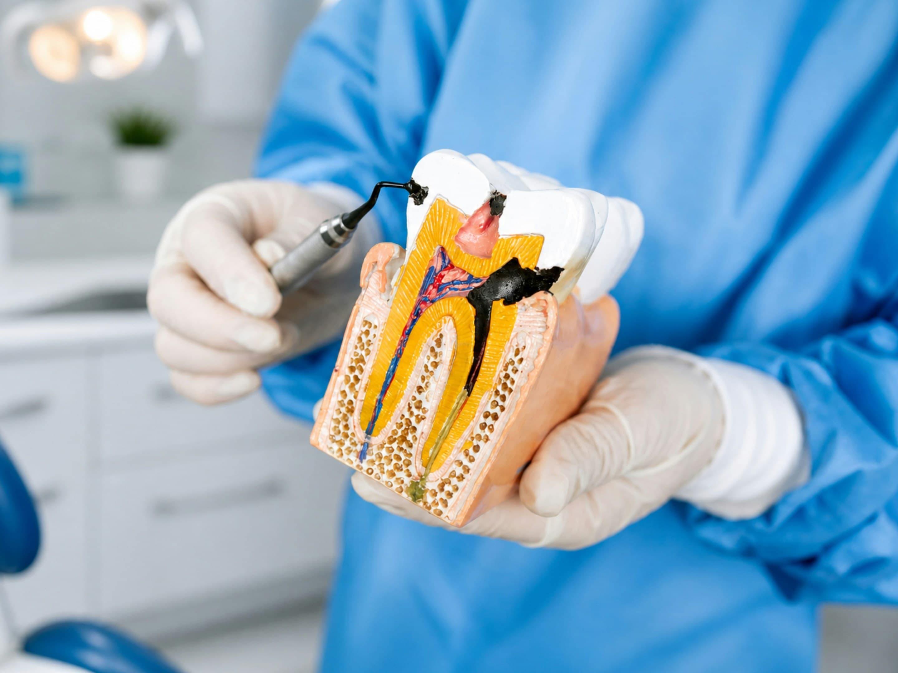 Root canal treatment at Hafeez Dental Care